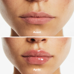 Lip Volume